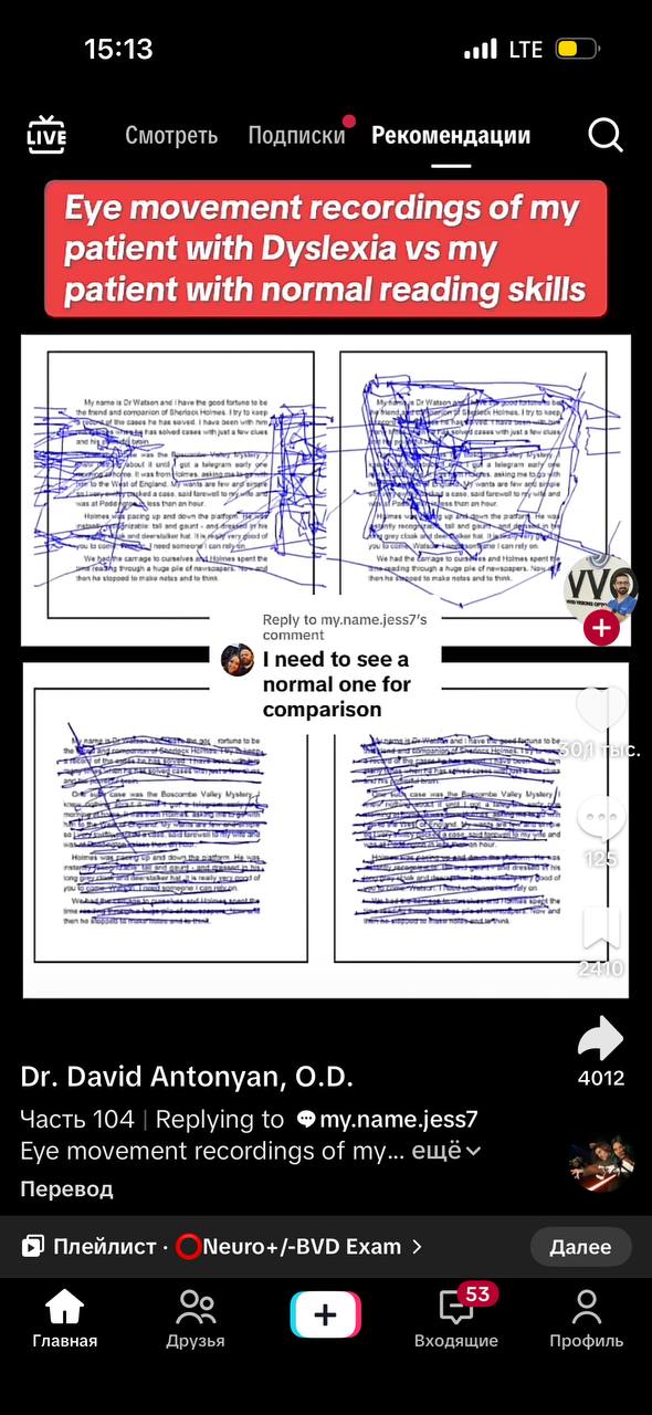 15:13 all LTE LIVE Смотреть Подписки Рекомендации Eye movement recordings of my patient with Dyslexia my _patient with normal reading if Reply to my.name.jess7’s comment to 5ее а normal one for compar