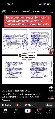 15:13 all LTE LIVE Смотреть Подписки Рекомендации Eye movement recordings of my patient with Dyslexia my _patient with normal reading if Reply to my.name.jess7’s comment to 5ее а normal one for compar