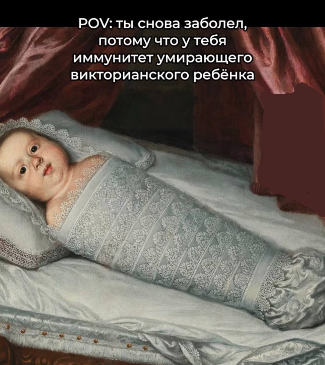 POV: ты снова заболел, потому что у тебя иммунитет умирающего викторианского ребёнка
