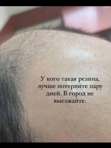 мне очень по секрету говоря грустно с шуток про лысеющих пацанов но есть в этом какое то успокоительное возмездие