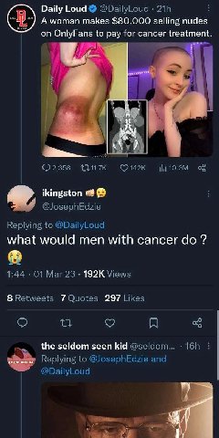 Daily Loud A woman makes $80, 000 selling nudes on OnlyFans to pay for cancer treatment ikingston what would men with cancer до 192К 7 297 the seldom seen kid