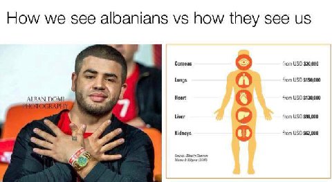 How we see albanians how they see Comeas from USD $30,000 Lungs from USD $150,000 ALBAN РОМ] 7 Heart from USD $130,000 Liver from USD $98,000 Kidneys from USD $62,000