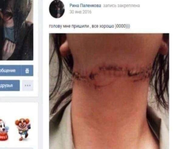 4 Рина Паленкова голову пришили все хорошо }0000)) друзья ihe