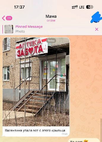 Всем привет Валентина упала вот с этого крыльца