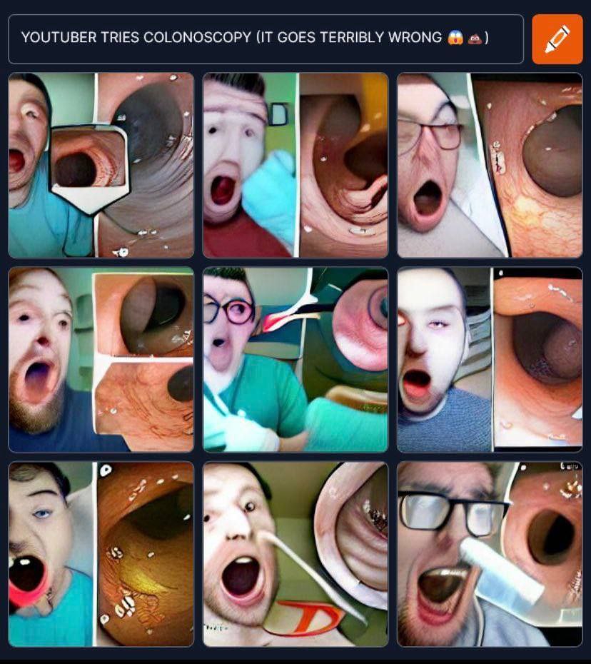 YOUTUBER TRIES COLONOSCOPY (iT GOES TERRIBLY WRONG 20