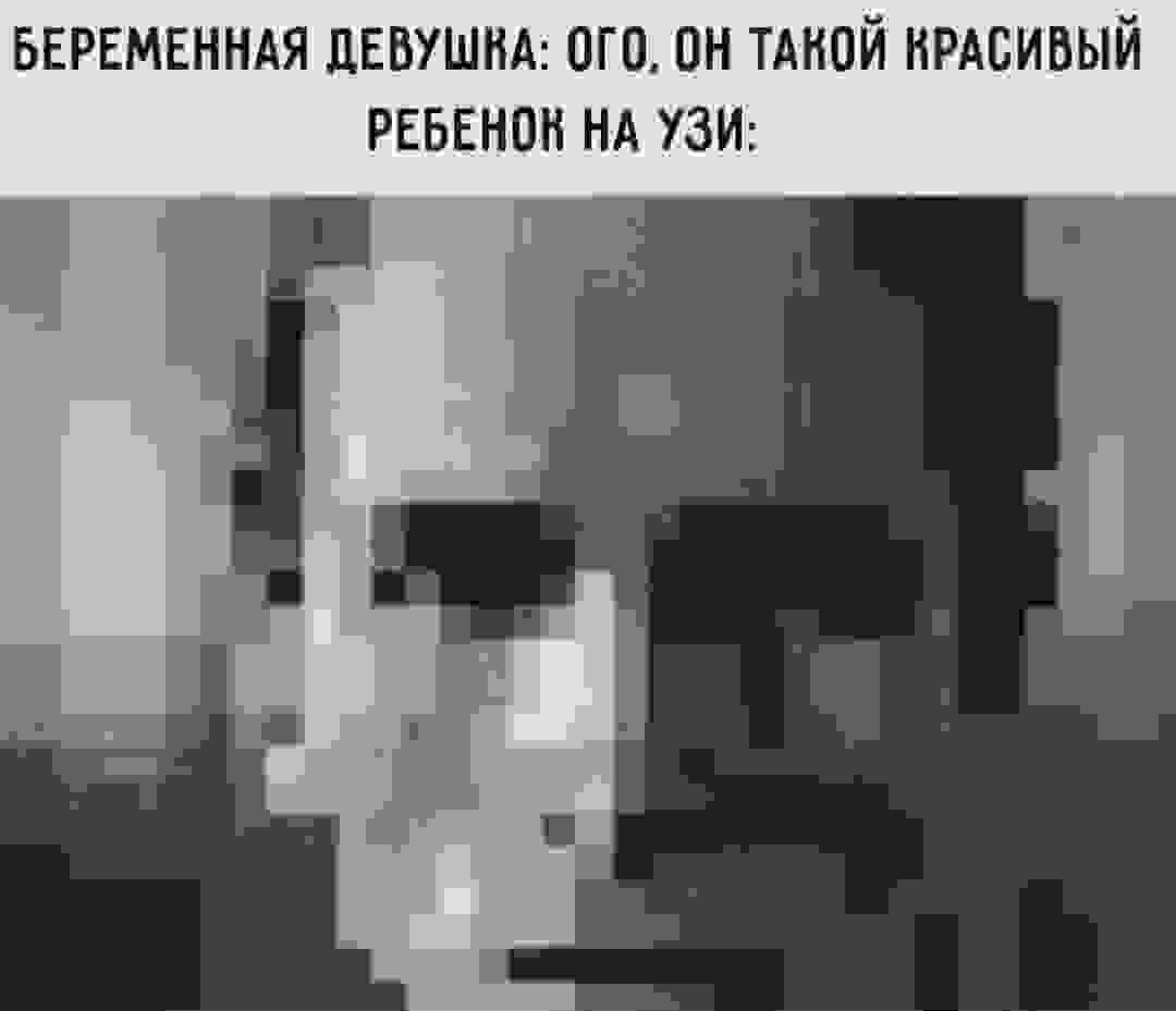 БЕРЕМЕННАЯ ДЕВУШКА: ОГО, ОН ТАКОЙ КРАСИВЫЙ РЕБЕНОН НА УЗИ: