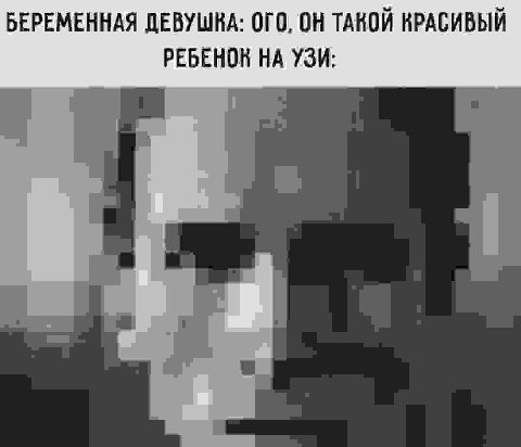 БЕРЕМЕННАЯ ДЕВУШКА: ОГО, ОН ТАКОЙ КРАСИВЫЙ РЕБЕНОН НА УЗИ: