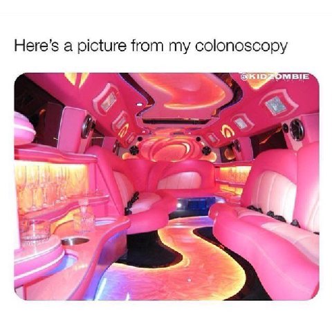 Here’s a picture from my colonoscopy 4 4
