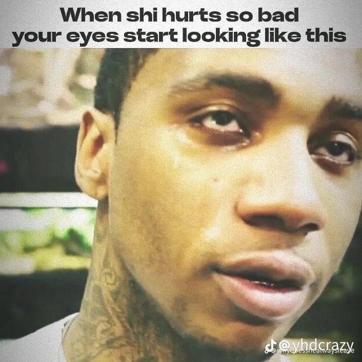 When shi hurts so bad your eyes start looking like this