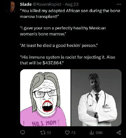 Slade "You killed my adopted African son during the bone marrow transplant!" gave your son a perfectly healthy Mexican woman's bone "At ieast he died a good Пескт' person." "His Immune system is racis
