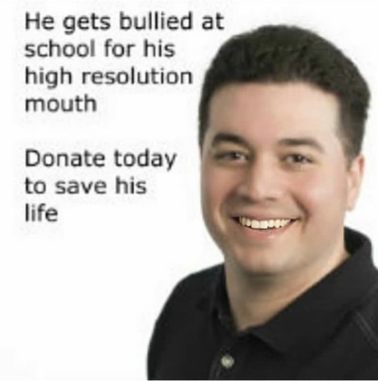 Не gets bullied at school for his high resolution mouth Donate today to save his life