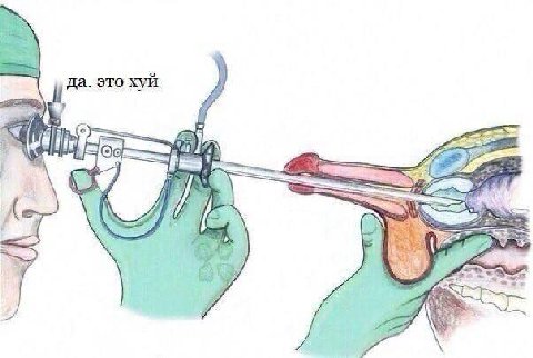 да. это хуи