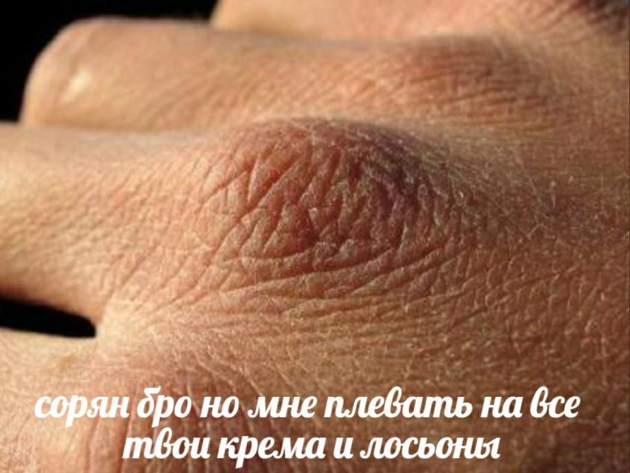 бро но мне плевать на bce крема и лосьоны