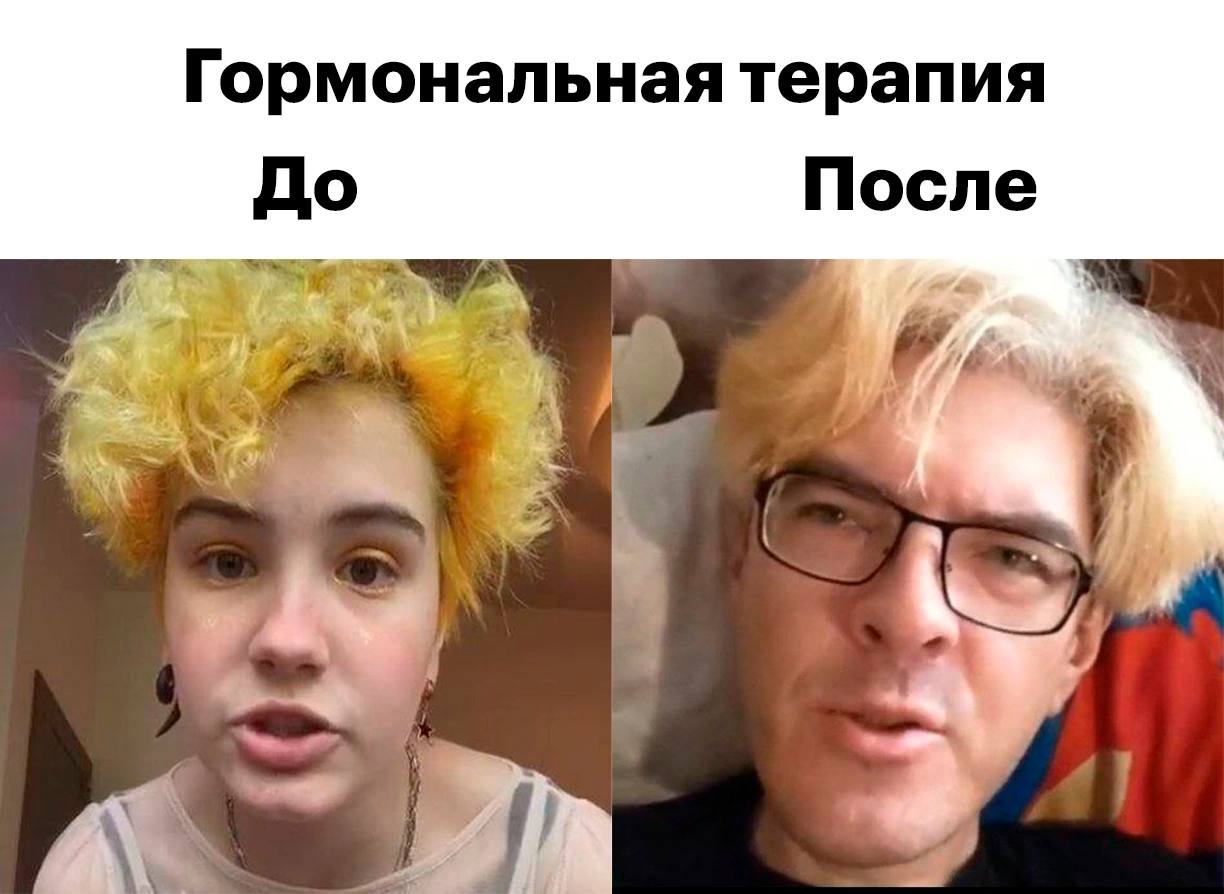 Гормональная терапия До После 4 к,