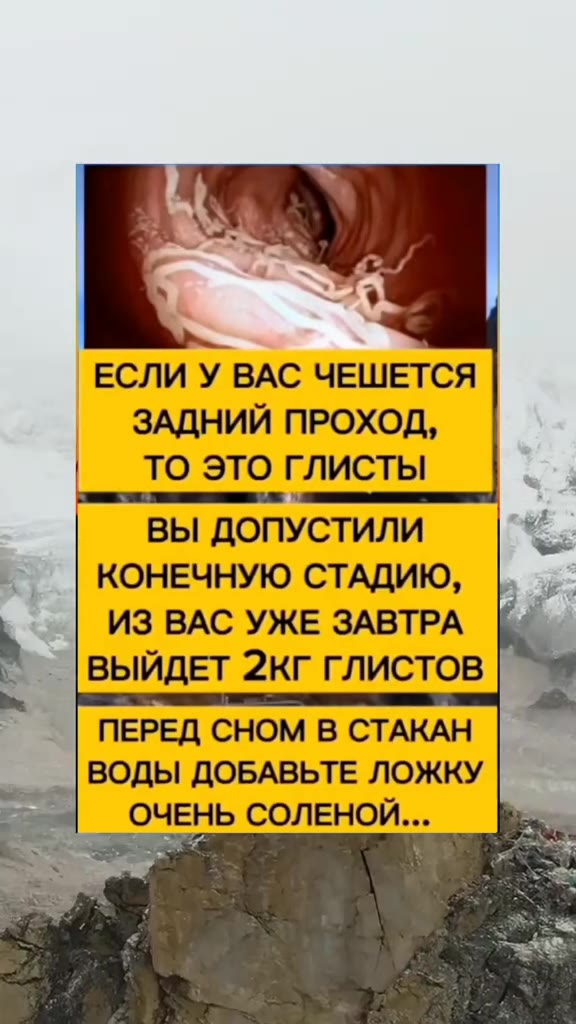 ЕСЛИ У ВАС ЧЕШЕТСЯ ЗАДНИЙ ПРОХОД, TO ЭТО ГЛИСТЫ ВЫ ДОПУСТИЛИ <: КОНЕЧНУЮ СТАДИЮ, |. . . ИЗ ВАС УЖЕ ЗАВТРА [4 ПЕРЕД СНОМ В СТАКАН ВОДЫ ДОБАВЬТЕ ЛОЖКУ РА : ОПУСТИЛИ
