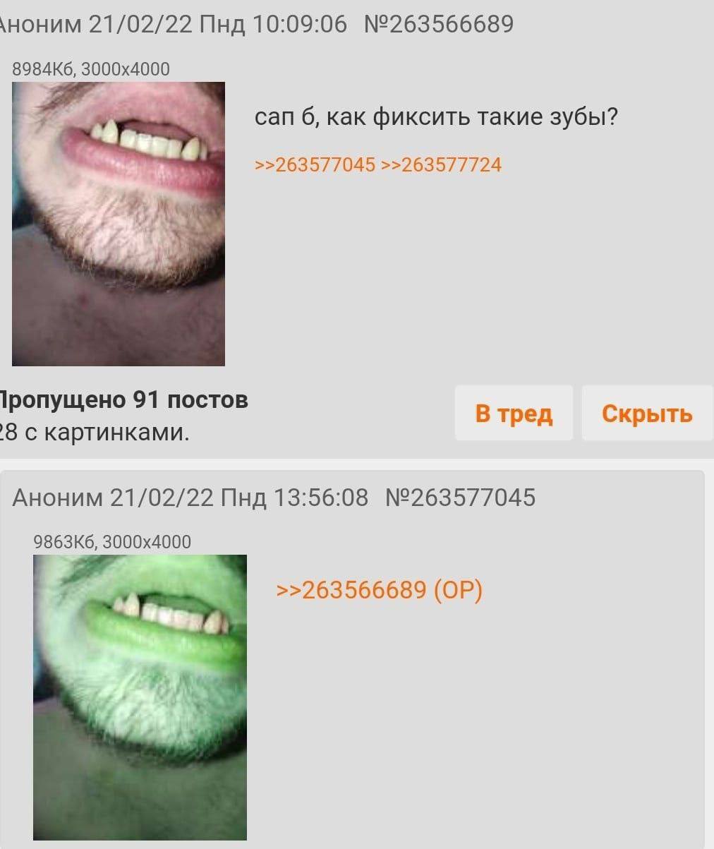 \ноним 21/02/22 Пнд 10:09:06 №263566689 can 6, как фиксить такие зубы? >>263577045 >>263577724 1ропущено 91 постов В тред Скрыть с картинками. Аноним 21/02/22 Пнд 13:56:08 №263577045 >>263566689