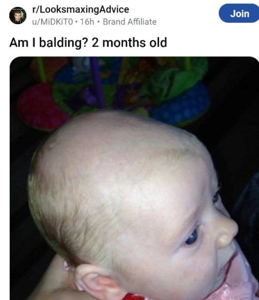 Join u/MiDKiTO Brand Affiliate 1 balding? 2 months old