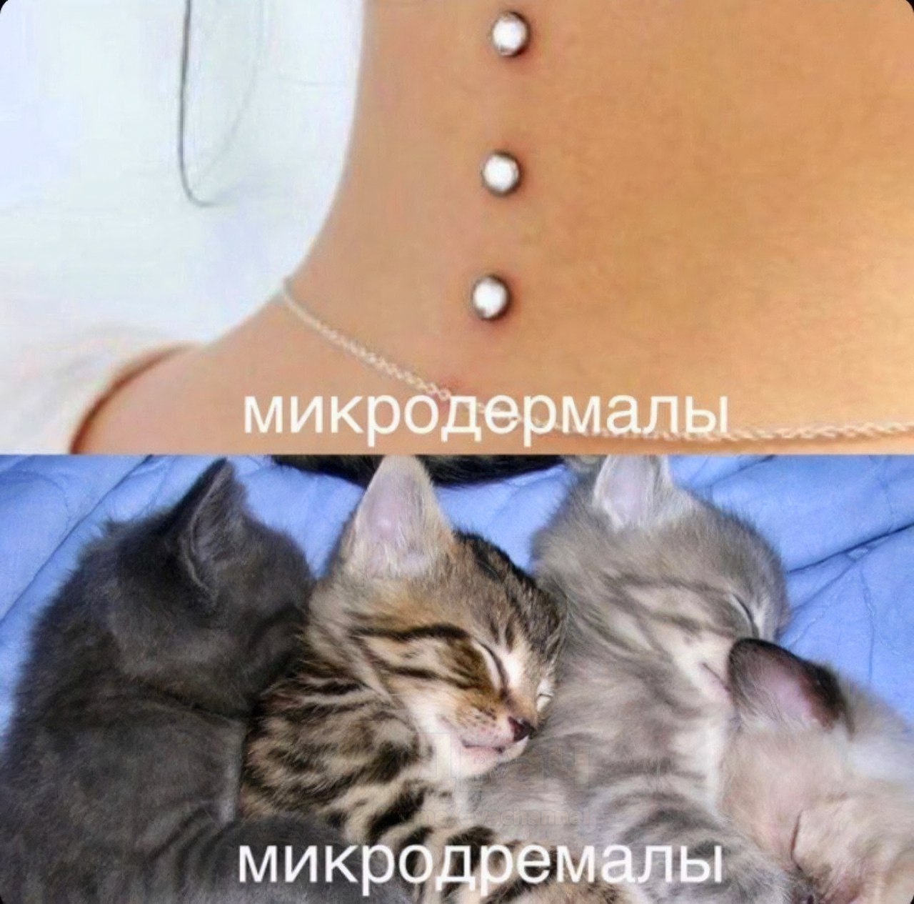 микродер 3 микродремалы