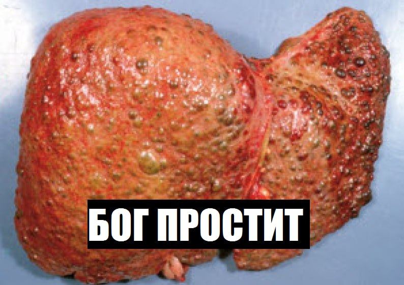 БОГ ПРОСТИТ