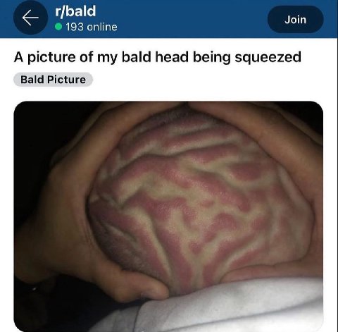 r/bald 193 online Join A picture of my bald head being squeezed Bald Picture