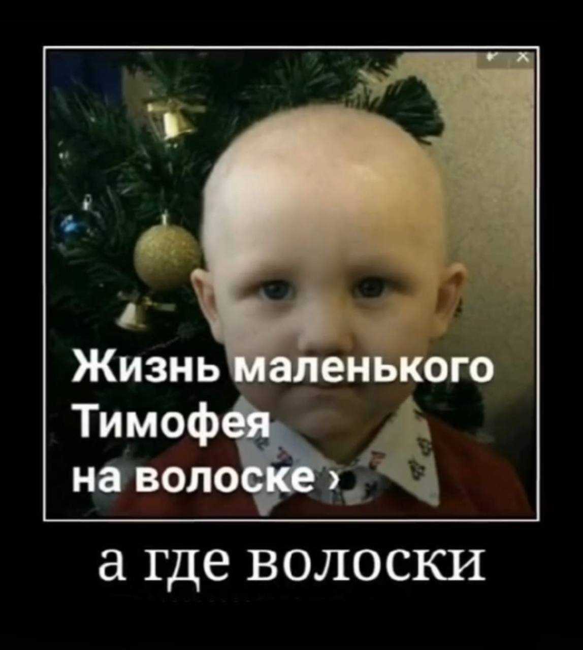 Жизнь маленького Тимофея на волоске а где волоски