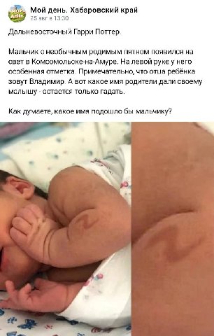Мой день. Хабаровский край 25 авг в 13:30 Дальневосточный Гарри Поттер. Мальчик с необычным родимым пятном появился на свет в Комсомольске-на-Амуре. На левой руке у него особенная отметка. Примечатель