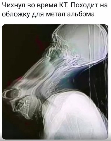 Чихнул во время Походит на обложку для метал альбома А