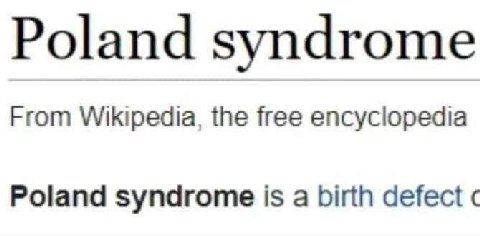 Poland syndrome From Wikipedia, the free encyclopedia Poland syndrome is a birth defect