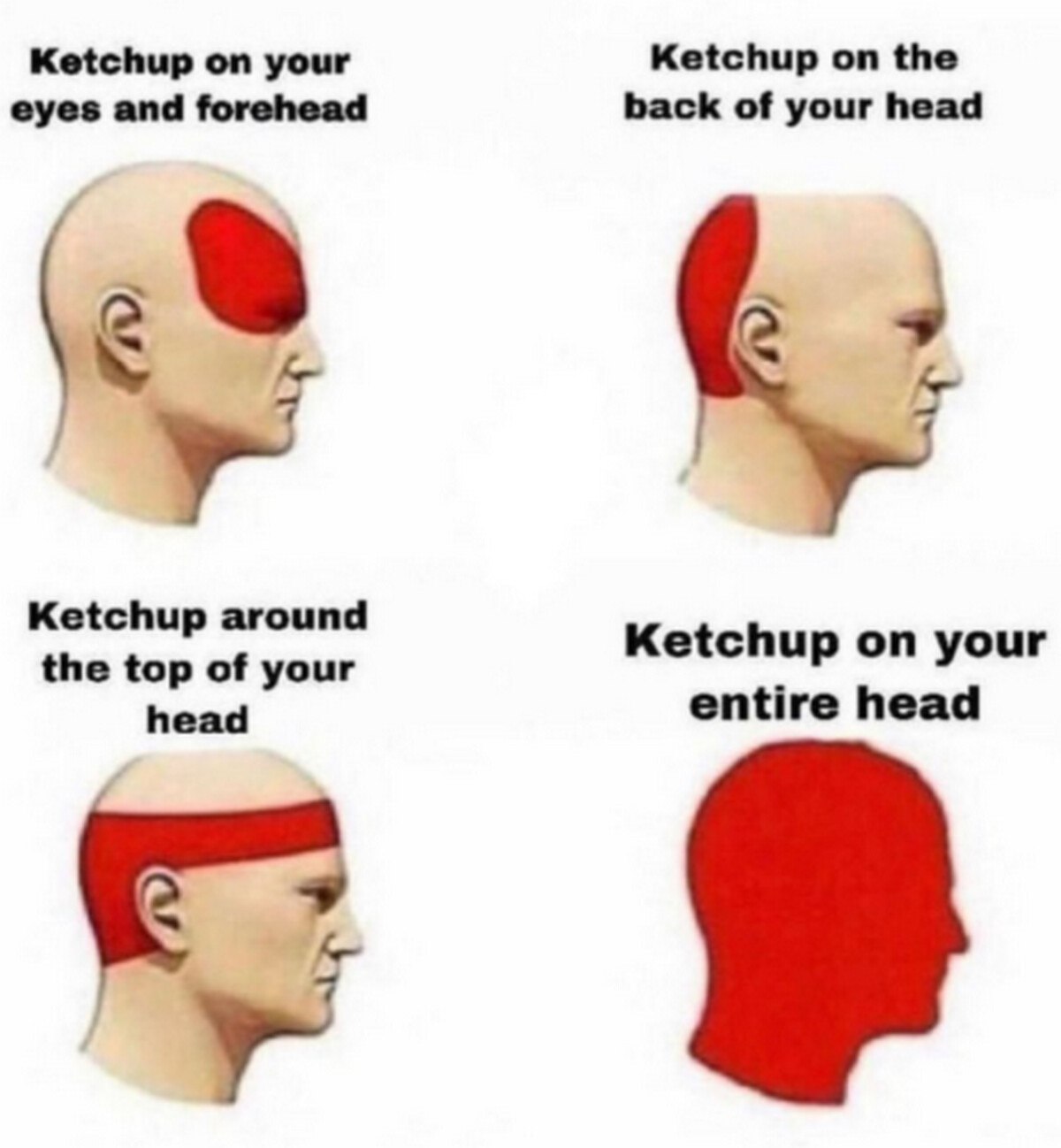 Ketchup on your Ketchup on the eyes and forehead back of your head 4 Ketchup around the top of your Ketchup on your head entire head