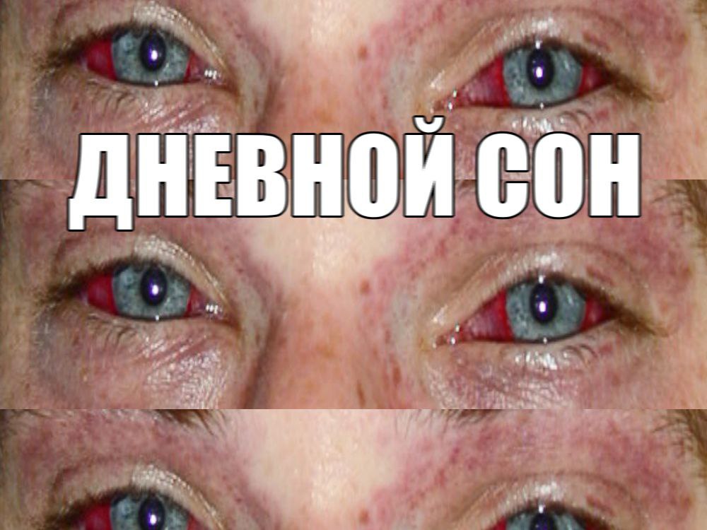 ДНЕВ