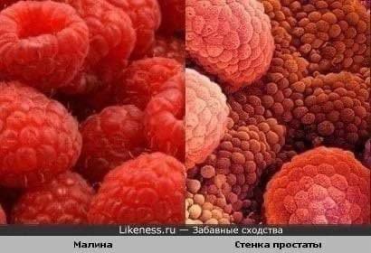 Likeness.ru Малина Стенка