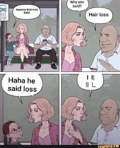 Why you bald? Mommy that man bald! BUS Hair loss ТОР 77; 740 Haha he Said loss UGS И