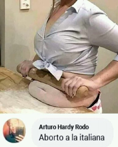 у Arturo Hardy Водо Aborto a italiana
