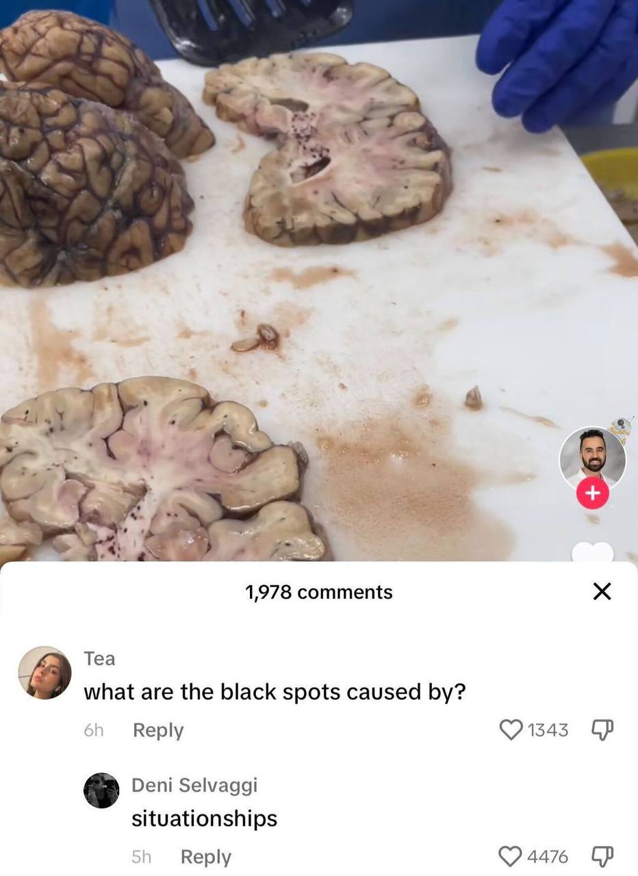 1,978 comments Tea what are the black spots caused Reply Deni Selvaggi situationships Reply 4476