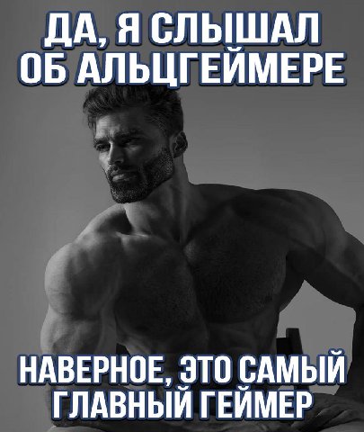 ДА, Я СЛЫШАЛ ОБ АЛЬЦГЕИМЕРЕ НАВЕРНОЕ, ЭТО САМЫЙ ГЛАВНЫЙ ГЕЙМЕР
