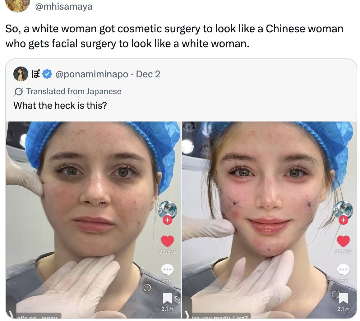 @mhisamaya So, a white woman got cosmetic surgery to look like a Chinese woman who gets facial surgery to look like a white woman. в @ponamiminapo Dec 2 Translated from Japanese What the heck is this?