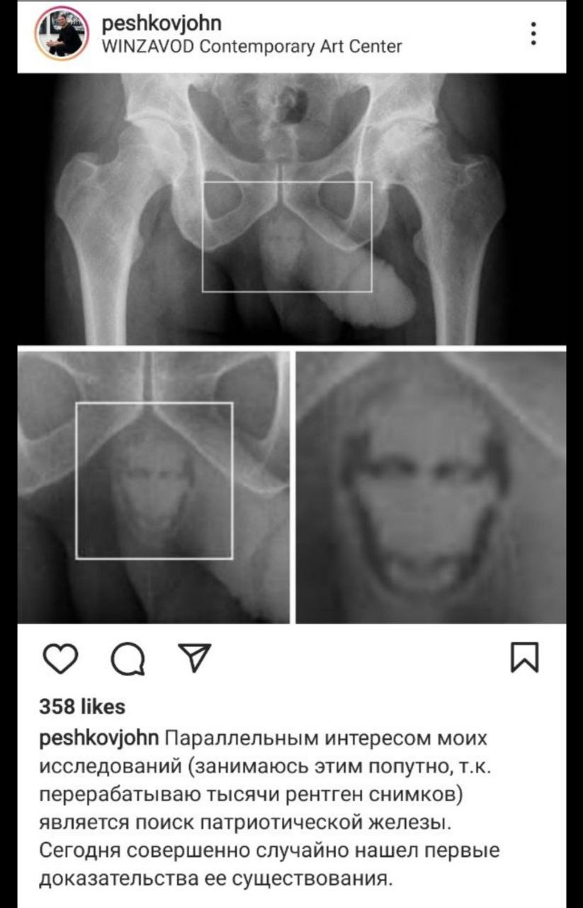 peshkovjohn WINZAVOD Contemporary Art Center аут 358 likes peshkovjohn Параллельным интересом моих исследований (занимаюсь этим попутно, перерабатываю тысячи рентген снимков) является поиск патриотиче