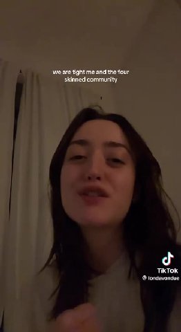 skinned community