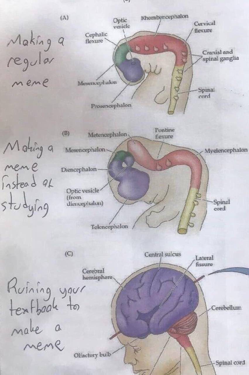 (A) Cervical Cephalic flexure Makin 9 Cranial and spinal ganglia i mene from cord Central sulcus Lateral to Cerebellum nth pale a bulb Spinal cord if
