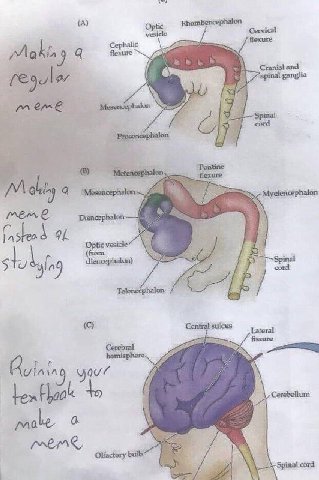 (A) Cervical Cephalic flexure Makin 9 Cranial and spinal ganglia i mene from cord Central sulcus Lateral to Cerebellum nth pale a bulb Spinal cord if