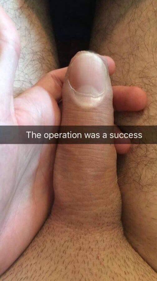 The operation was а success