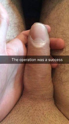 The operation was а success