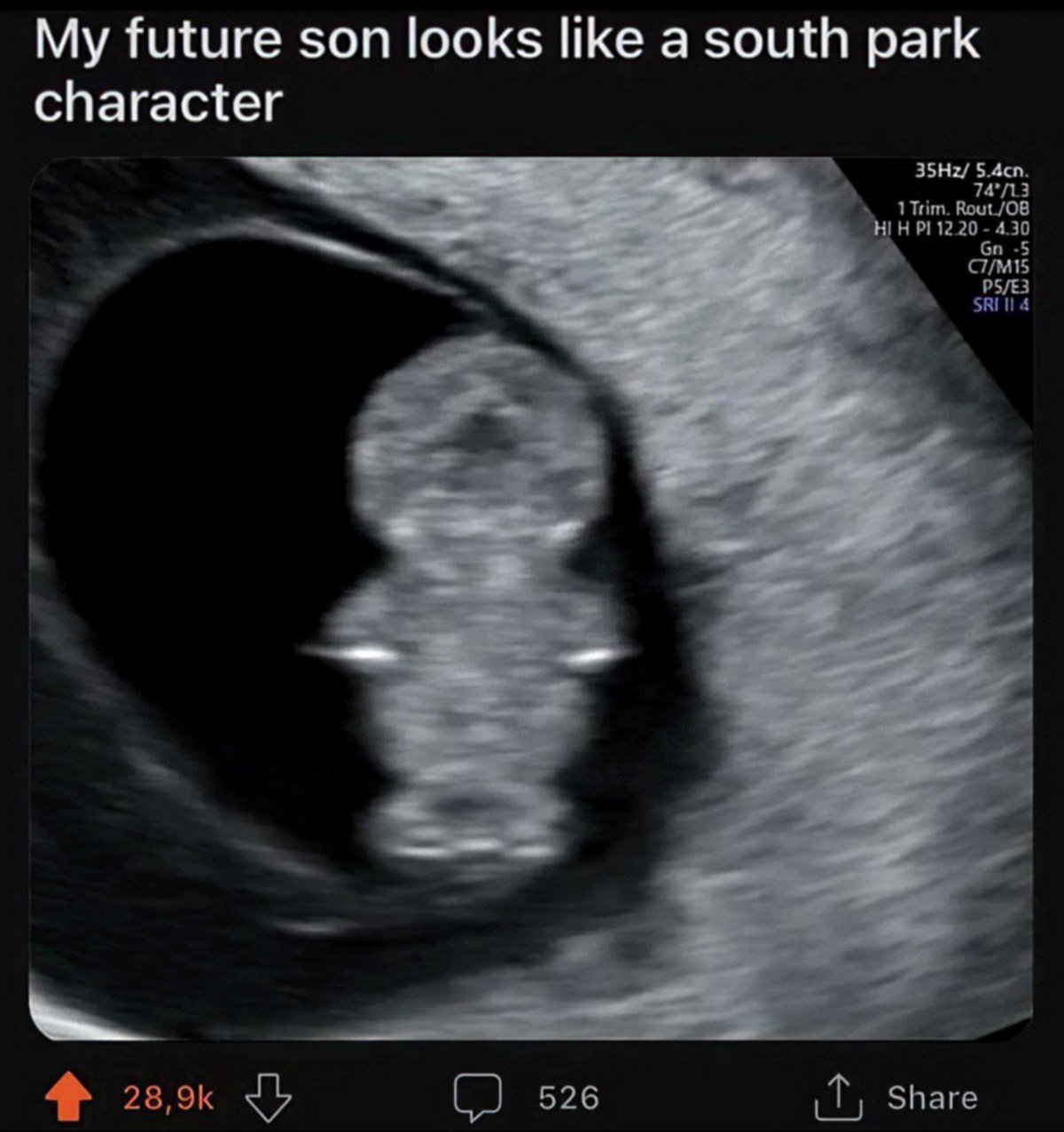 My future son looks like а south park character