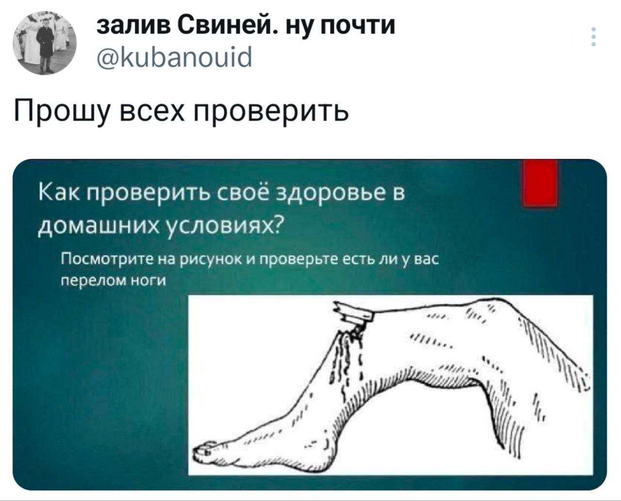 залив Свиней. ну почти Прошу всех проверить Как проверить CBOE здоровье в домашних условиях? Посмотрите на рисунок и проверьте есть ли у вас перелом ноги