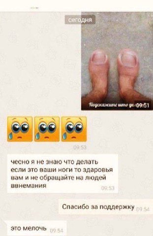 Подскажштие што чесно я не знаю что делать если это ваши ноги то здаровья вам и не обращайте на людей ввнемания Спасибо за поддержку это мелочь