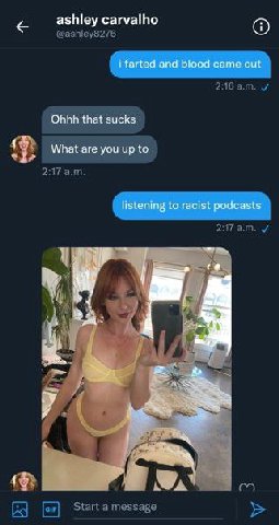 ashley carvalho i farted and blood came out Ohhh that sucks What are you up to listening to racist podcasts ANS