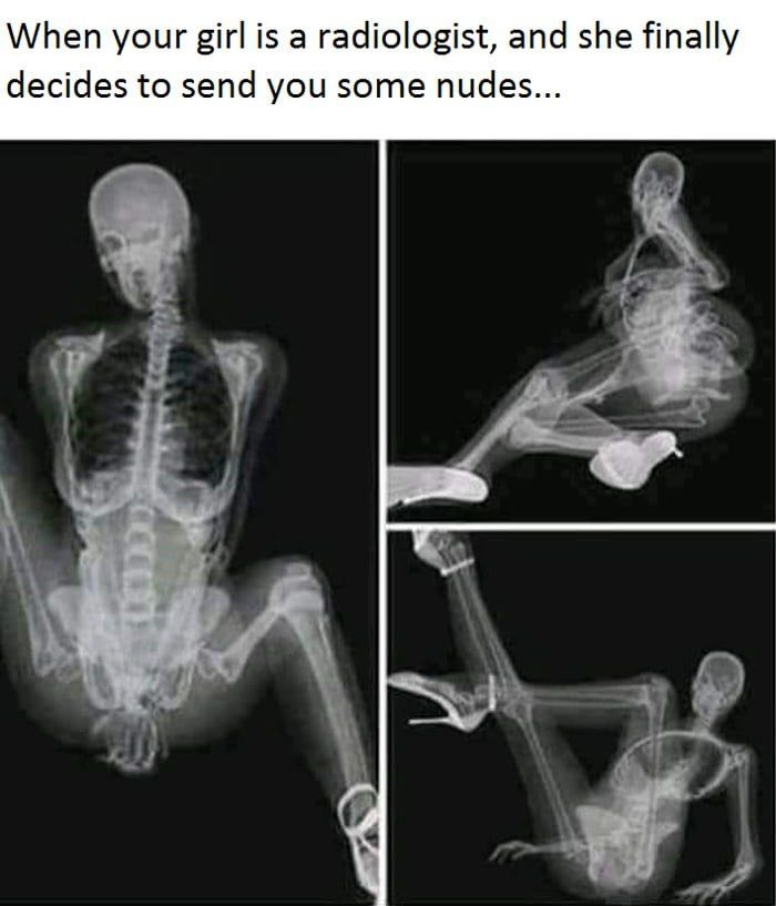 When your girl is а radiologist, and she finally decides to send you some nudes...