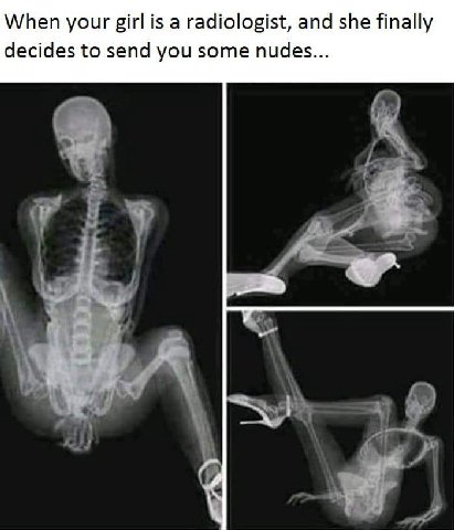 When your girl is а radiologist, and she finally decides to send you some nudes...