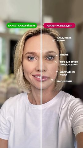 КАКАЕТ КАЖДЫЙ ДЕНЬ КАКАЕТ РАЗ В 2-3 ДНЯ БЛЕДНОСТЬ кожи ОТЕКИ ТЕМНЫЕ КРУГИ ПОД ГЛАЗАМИ ШЕЛУШЕНИЕ кожи И ВЫСЫПАНИЯ я 4 /A
