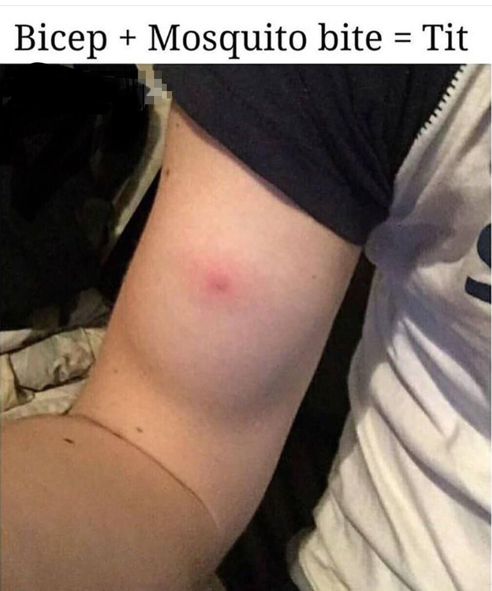 Bicep Mosquito bite Tit